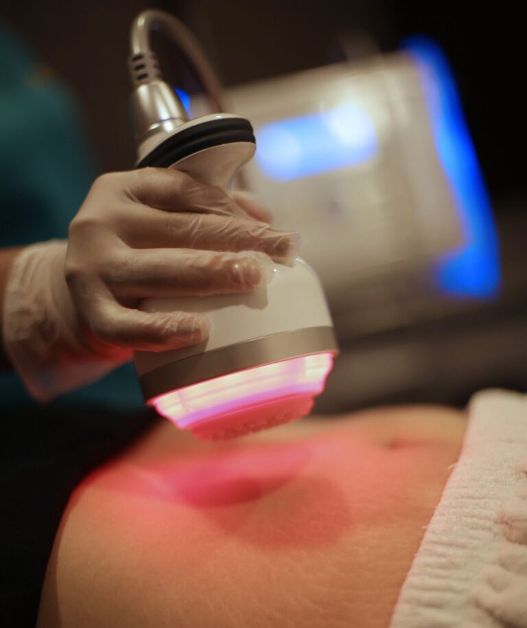 CAVITACION CLINICA RENACE GUATEMALA